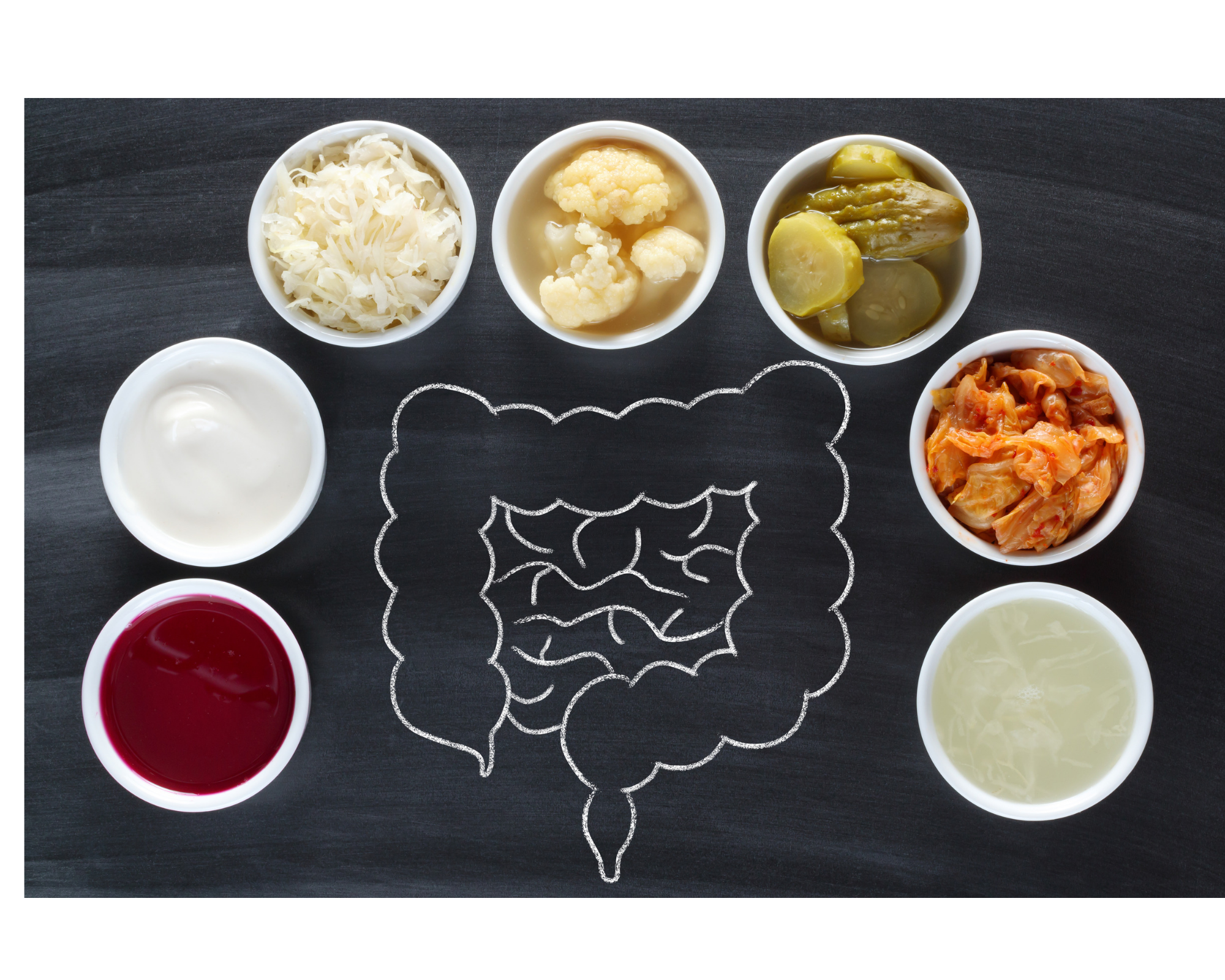 Adding Probiotic Rich Foods to your Diet can lead to a Healthy Gut.