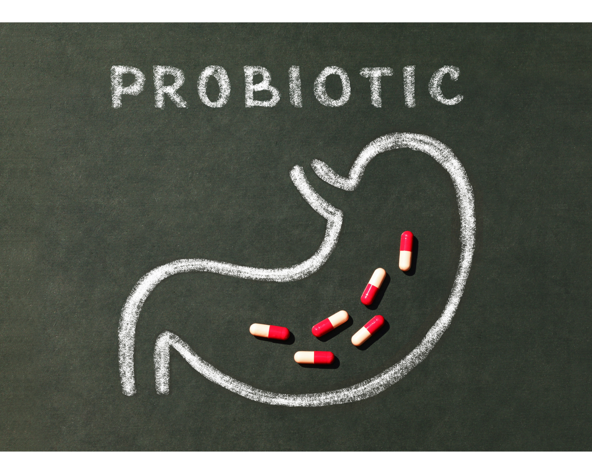 Probiotic Supplements are Essential for Gut Health.