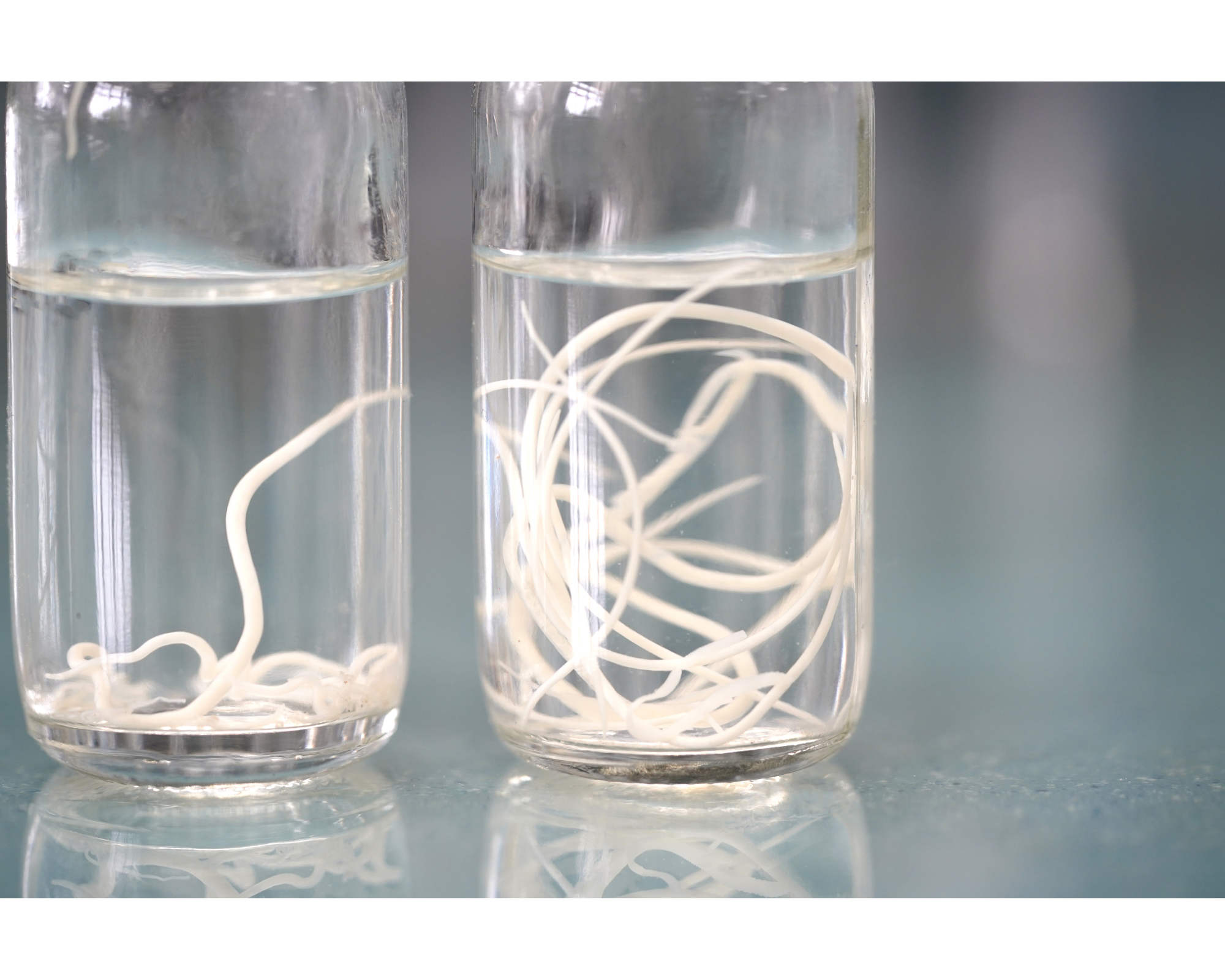 Intestinal worms are a common parasitic infection.