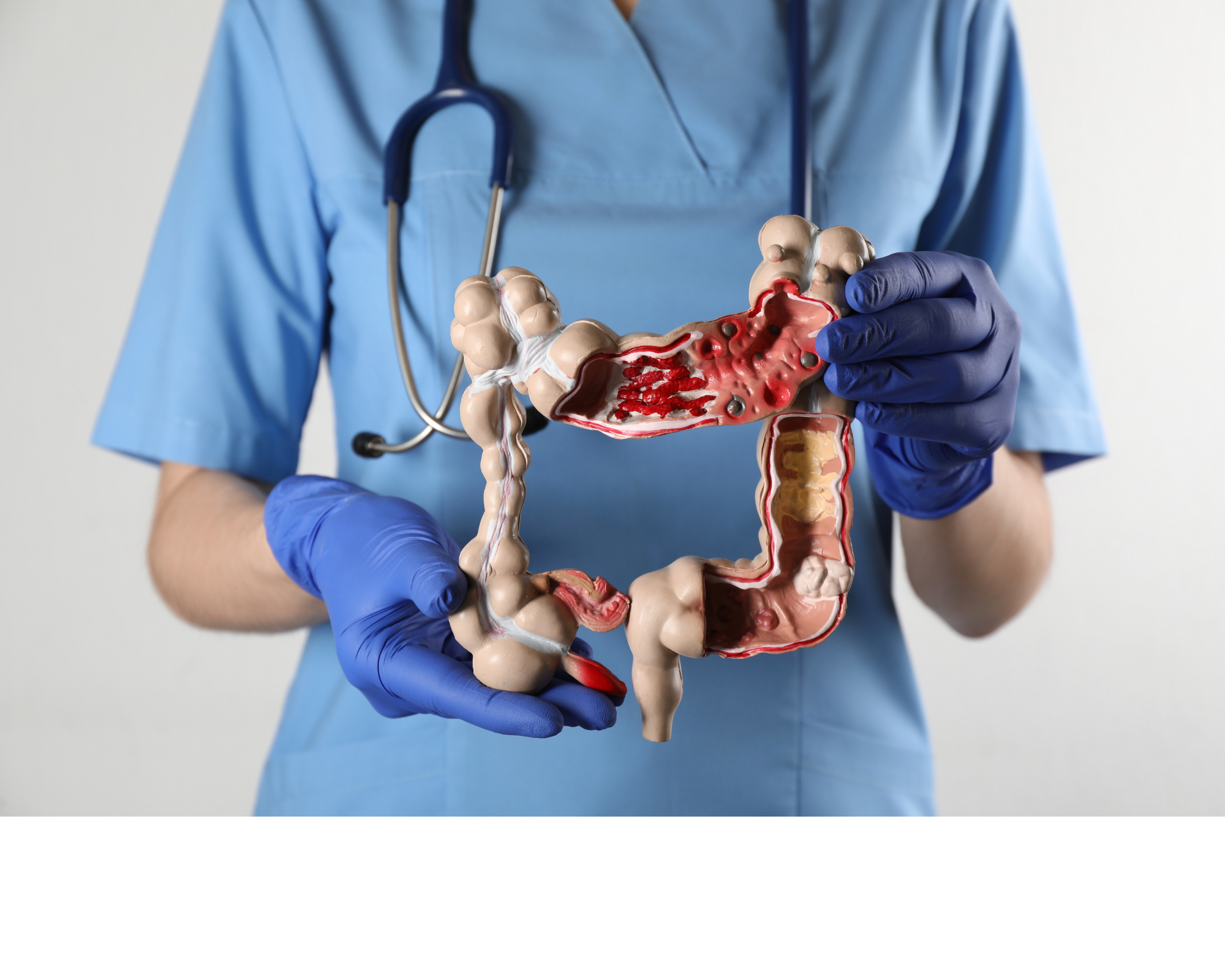 The colon is a part of your large intestine, colon health is crucial to your overall health and well-being. 