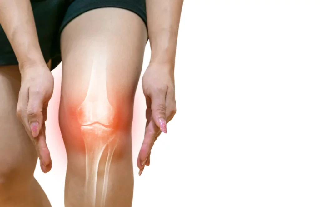 An anti-inflammatory diet may help reduce pain and improve joint function.