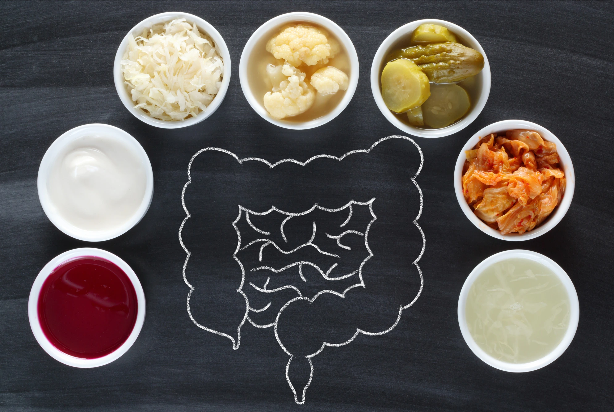 Adding probiotic and prebiotic foods to your diet can help support your gut microbiome.
